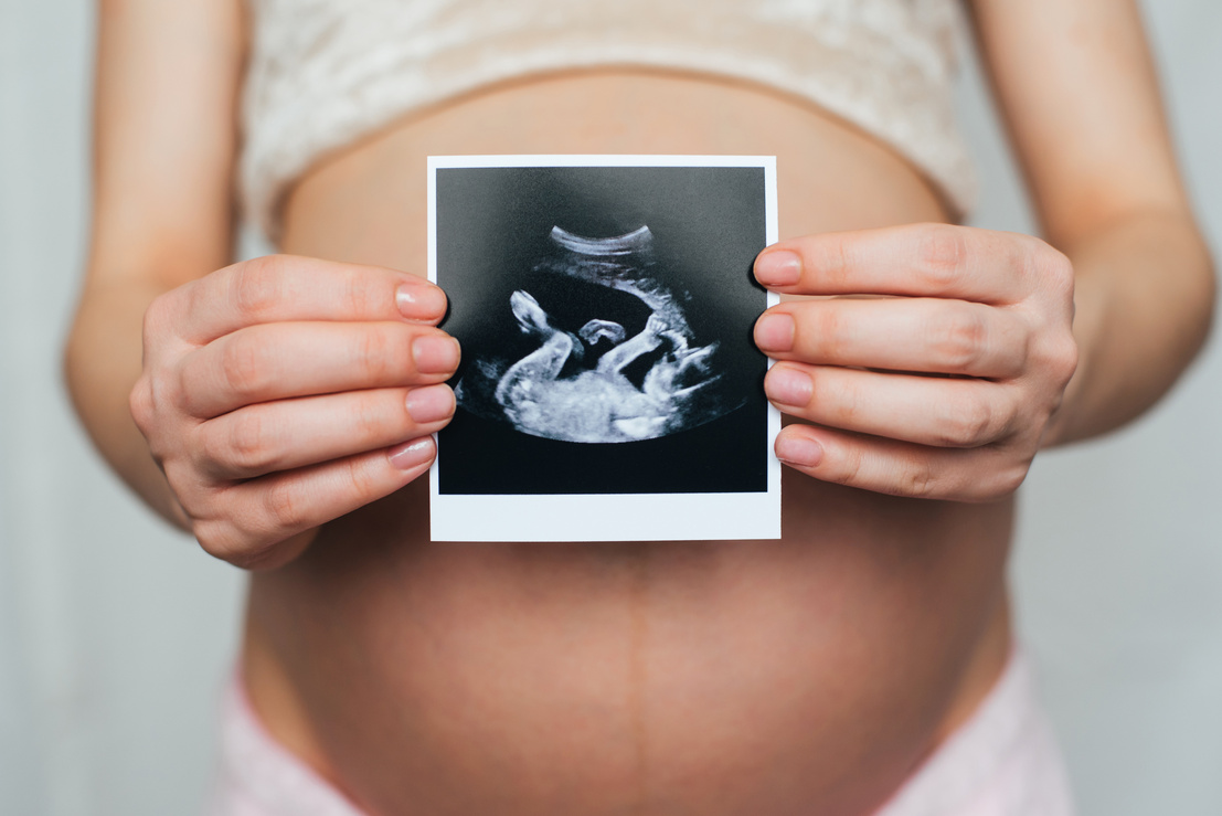 Pregnant Woman Holding Ultrasound Picture